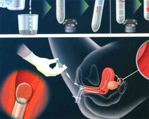 拉拉怎么生孩子可以要两个人卵子吗,福建天生同性恋，找福建供卵试管生殖中