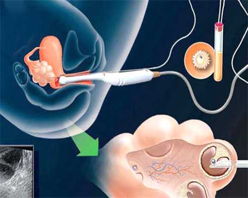 孕妈妈一定要同时补叶酸和维B12！！！