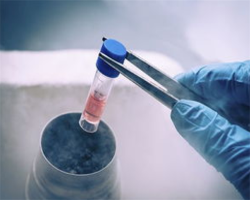 祛斑的食物爱美新妈吃起来