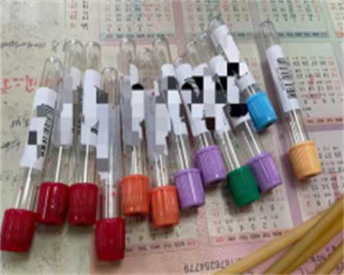 供卵试管有什么条件吗,黑龙江助孕机构哈尔滨助孕中介