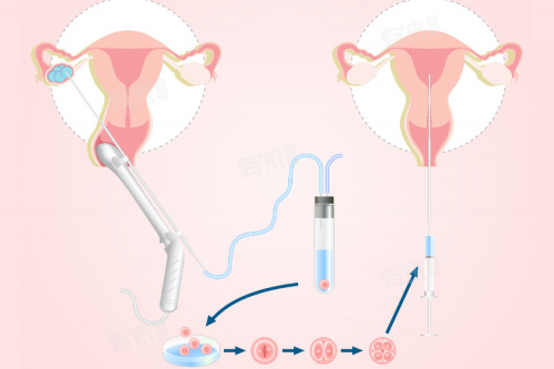 两个女人生孩子成功,【揭秘不同国家男女偏爱不同性姿势】