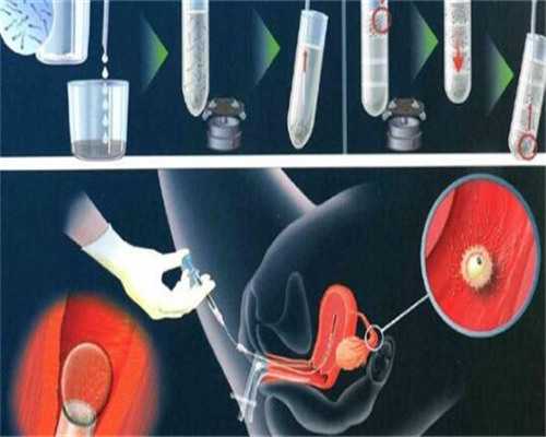 人工授精服务：费用明细与价格解析