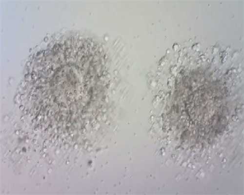 有几家供卵试管网站,广州助孕机构收费试管助孕机构