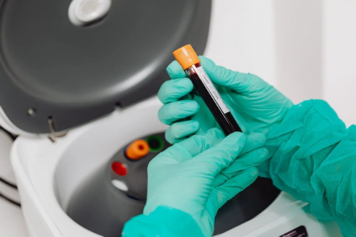 试管婴儿囊胚移植前为什么要打肝素？-供卵代生全包