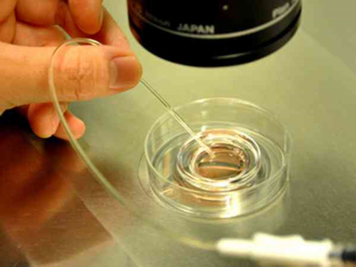 代生供卵平台,广州助孕公司有哪些_试管助孕机构