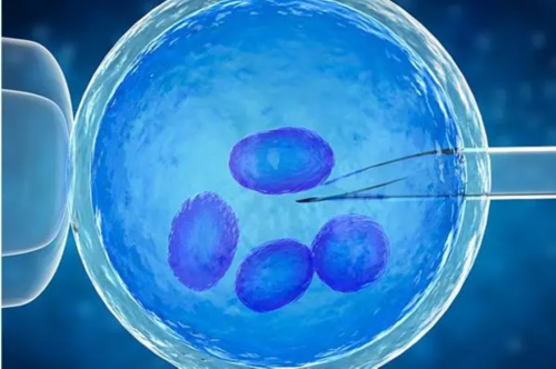 什么人不适合上环，上环有哪些坏处