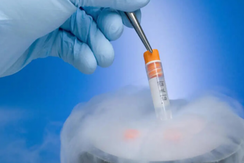 哺乳期吃什么好