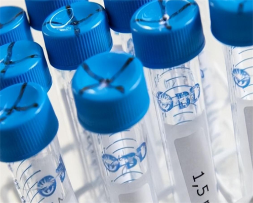 新妈妈夏天坐月子切记饮食7大禁忌