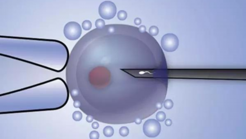 拉拉a卵b怀可行吗,试管婴儿助孕中心：同性可以试管婴儿么？