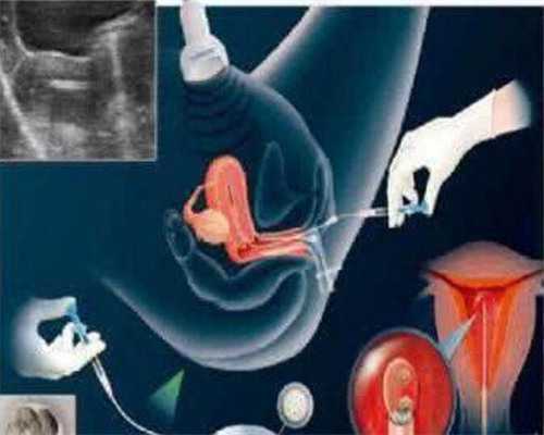 女的和女的能生孩子么,兰州同性试管2代多少钱-正规助孕医院