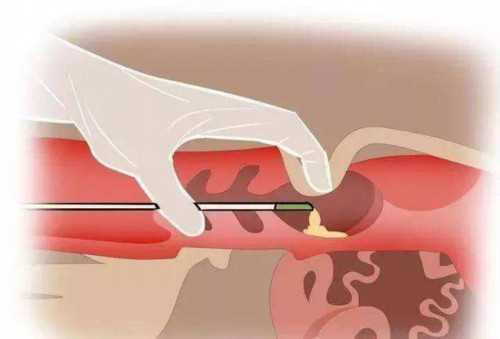 供卵代怀小孩多少钱,石家庄最大助孕公司_正规助孕网