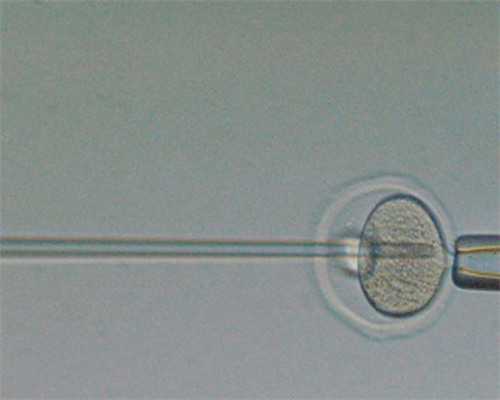 私人医院供卵试管费用,石家庄助孕微信群_试管助孕机构