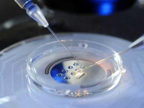 les生孩子有哪些方法,银川同性恋想要孩子怎做-试管助孕机构