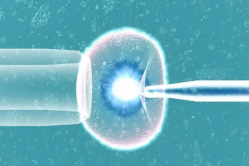 孕囊的形状如何判断胎儿性别?怀孕期间如何观察男女胎儿?