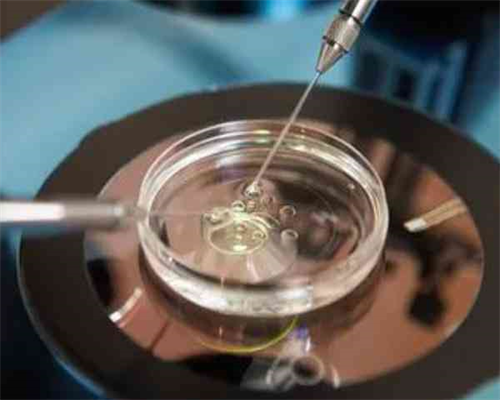 同性试管,同性恋可以试管生孩子吗，在我国是不允许的