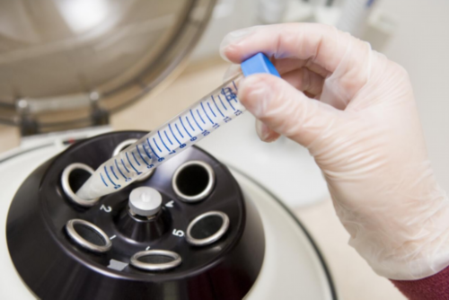 供卵试管包生孩子费用,哈尔滨助孕中心-试管助孕机构