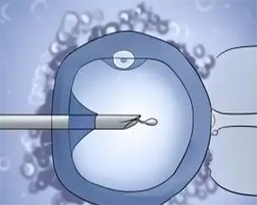 哺乳期减肥的要点，哺乳期减肥的注意事项