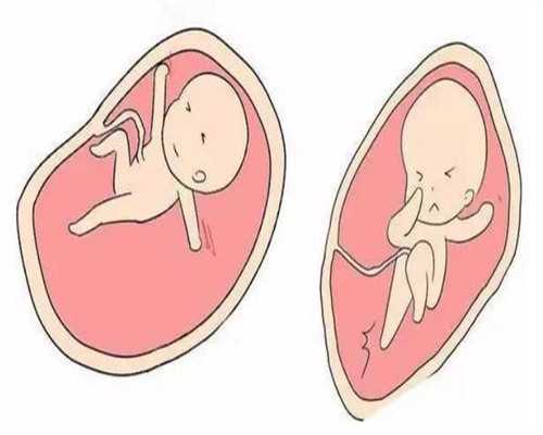 中山三院供卵,中山六院供卵