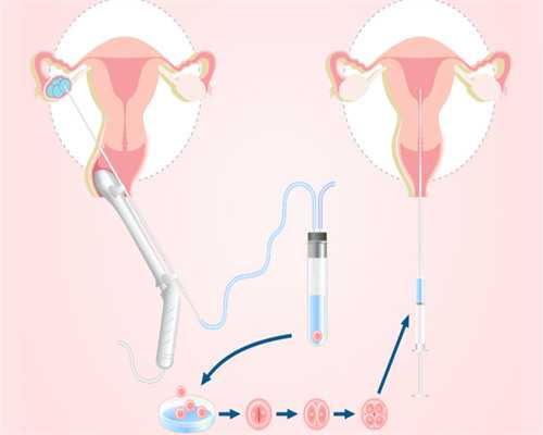 两个女性生孩子的技术,武汉私立供卵试管助孕机构同性恋可以做吗？