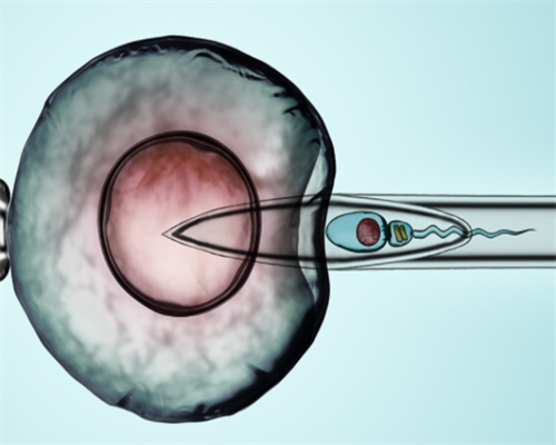 伦敦未婚女性寻求精子库,单身女性利用精子库生育