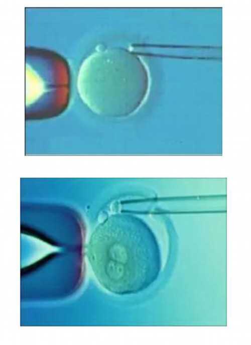 两个女人可以生孩子吗,武汉私立供卵试管助孕机构同性恋可以做吗？