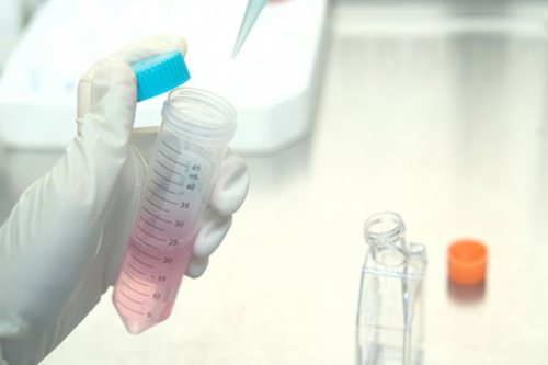 孕妇年龄达到35岁需要注意的事项