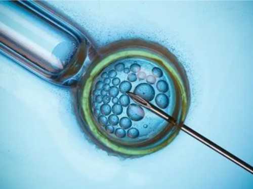 想生男孩有什么好方法吗？怎么才能生儿子概率比较高？