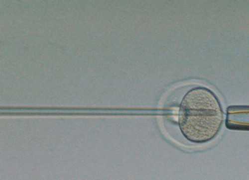
              香港试管医院中哪家做供卵三代技术好成功率高？
            