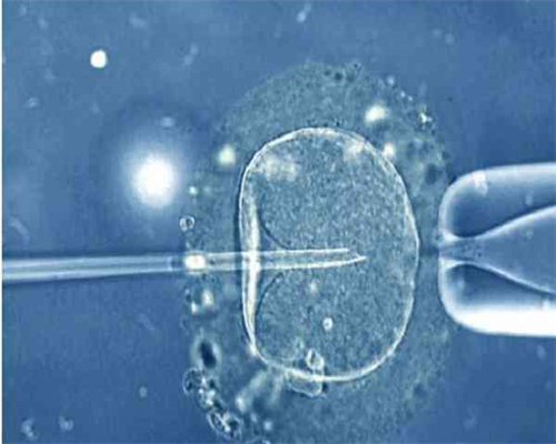 十堰试管的费用多少（同性试管哪个医院成功率最高）