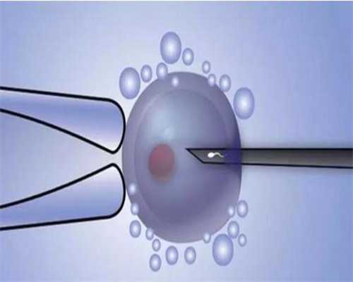 两个女性生孩子,同性试管双胞胎,二代试管双胞胎男女比例